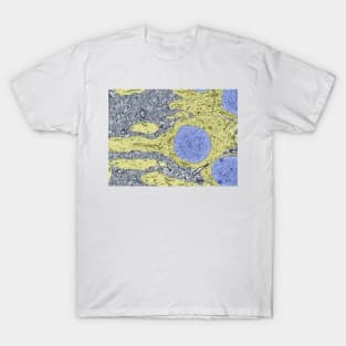 Hippocampus neuron, TEM (C029/8222) T-Shirt